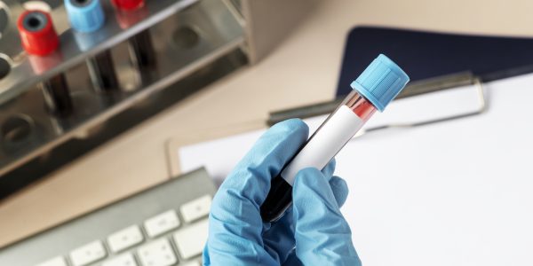 Surgeon holding a blood test